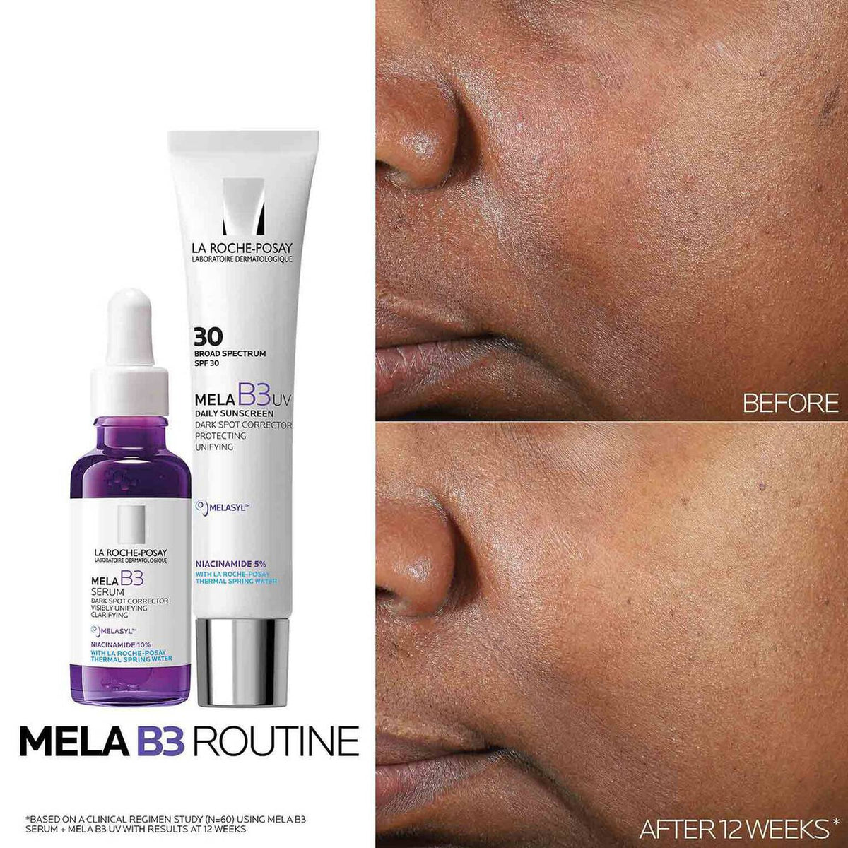 mela-b3-dark-spot-serum-and-mela-b3-uv-daily-moisturizer-with-spf-30-i2 3-Mela-B3-routine_1500X1500.jpg
