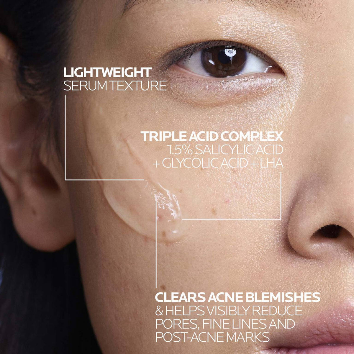 effaclar-salicylic-acid-acne-treatment-serum-j7 LaRochePosay-Product-Effaclar-Effaclar-Serum-30ml-3337875722827-Texture-REV.jpg