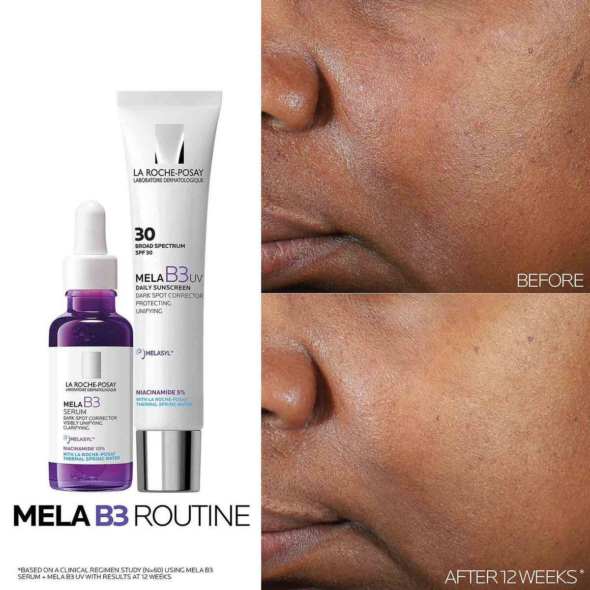 mela-b3-uv-daily-moisturizer-spf-30-with-melasyltm-niacinamide-z8 Mela-B3-routine_1500X1500.jpg