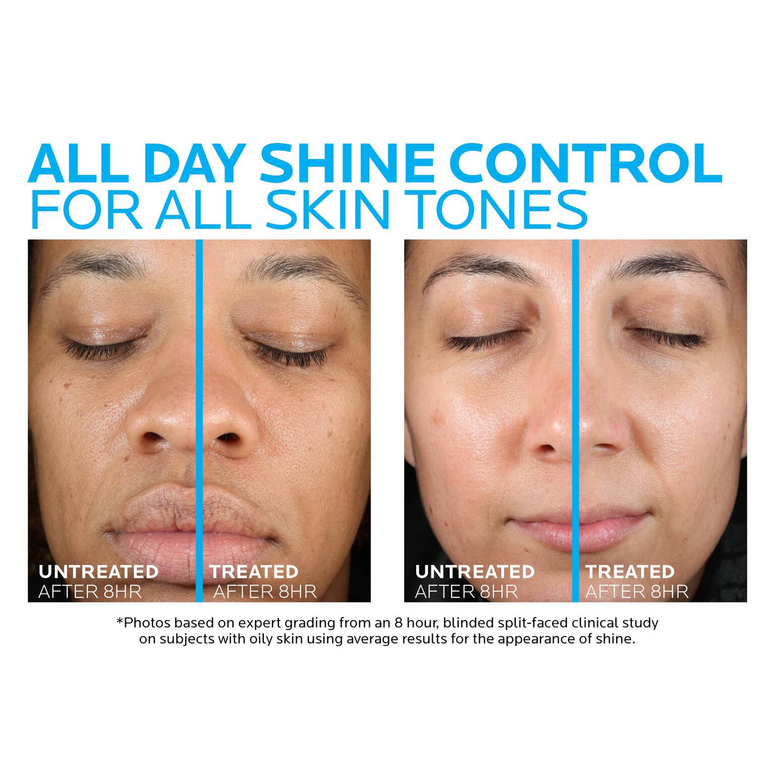 toleriane-double-repair-matte-face-moisturizer-for-oily-skin-y6 la-roche-posay-toleriane-matte-moisturizer-before-and-after-pdp-alt.jpg